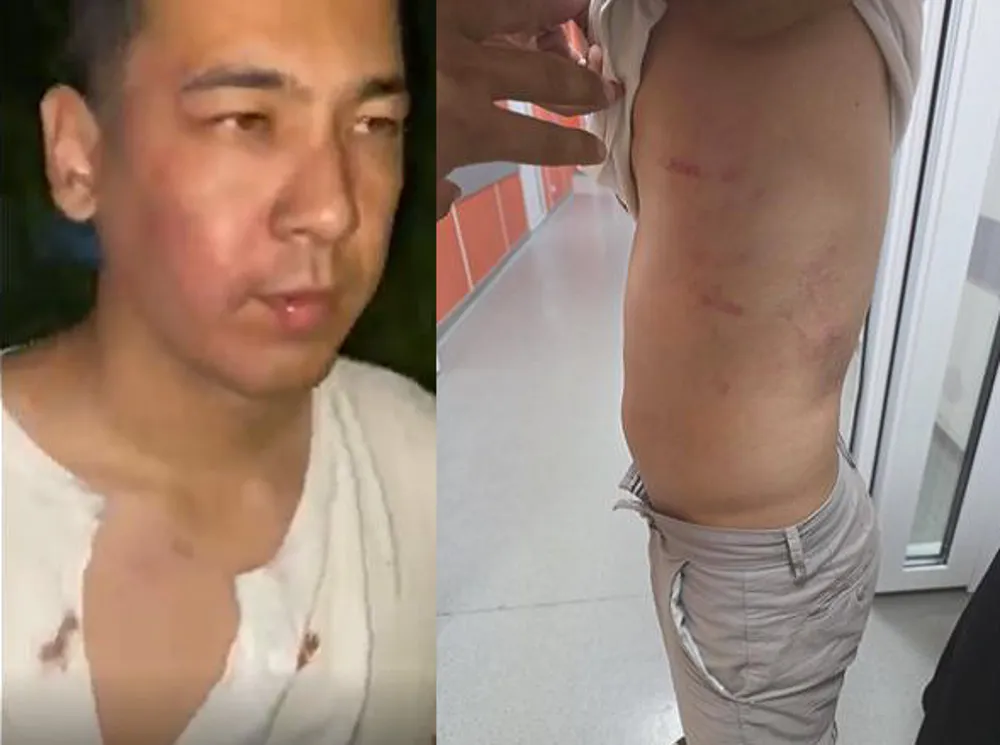 Daniyar Tursynbayev shows signs of torture